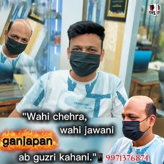 Say Goodbye to Hair Loss! 👋 Rizy Hair Solution lekar aaya hai 100% natural hairline wala Korean Hai