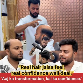 RIZY HAIR SOLUTION – INDIA’S TRUSTED HAIR PATCH CENTRE
✨ Natural Hair Patch Experts | Non Surgical H