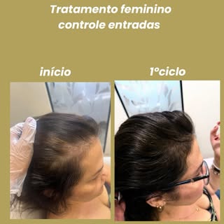Nosso protocolo para controle de “entradas” focamos muito na potência do crescimento do fio visando 