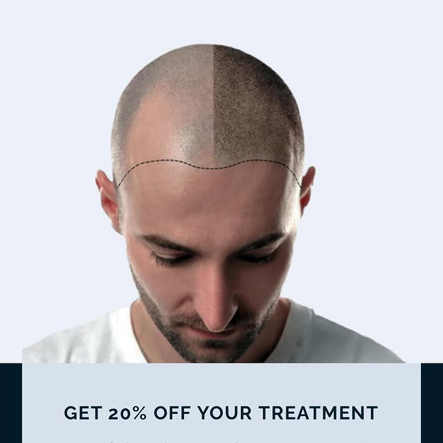 Start the summer with a new look ! 
20%off all scalp micro pigmentation procedures!
Dm or book on ht