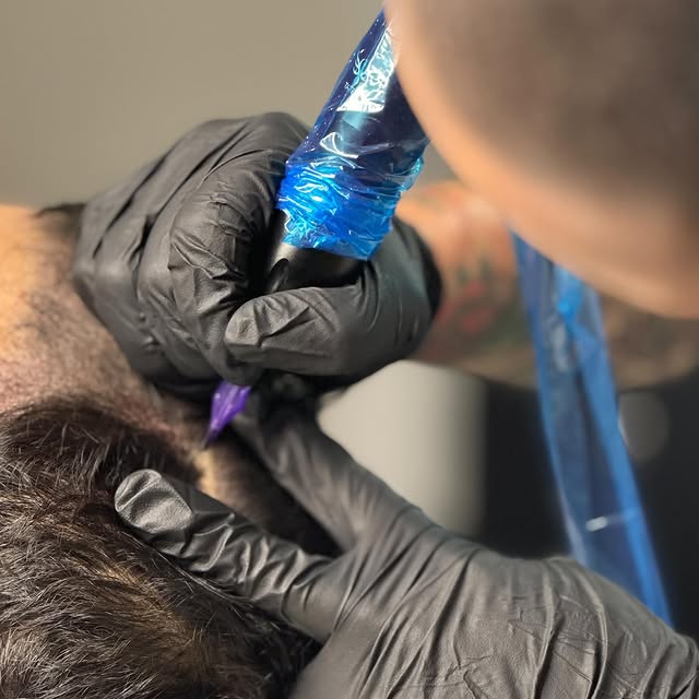 I’m just trying to boost men/woman’s confidence one client at a time with scalp micro pigmentation!
