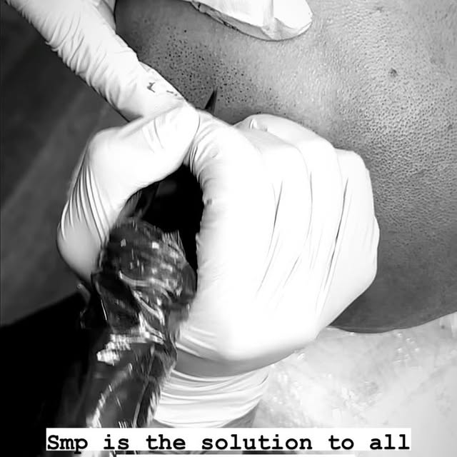 Dm to book a consultation! 
Visit Xposedsmp.com to see more of our work !