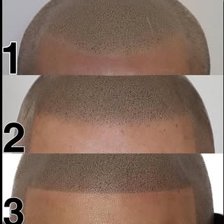 Whether you want the Sharp Barbershop Hairline or a contoured natural hairline, We Got You Covered! 