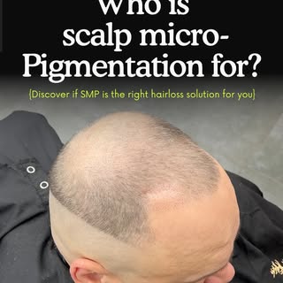Are you concerned about your Hairloss and not sure on the next steps to taking control?

Scalp micro