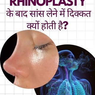 😮‍💨 Rhinoplasty ke baad saans lene mein dikkat? Kya ye normal hai?

Nose surgery ke baad kuch dino