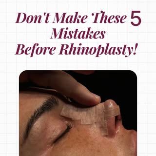 Thinking about getting a rhinoplasty? Read this first. 👃✨

The results of your nose surgery don't j