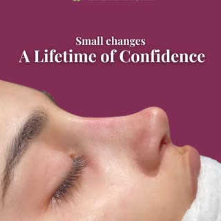 ✨ Confidence begins with feeling like the best version of yourself.

Rhinoplasty is more than just a