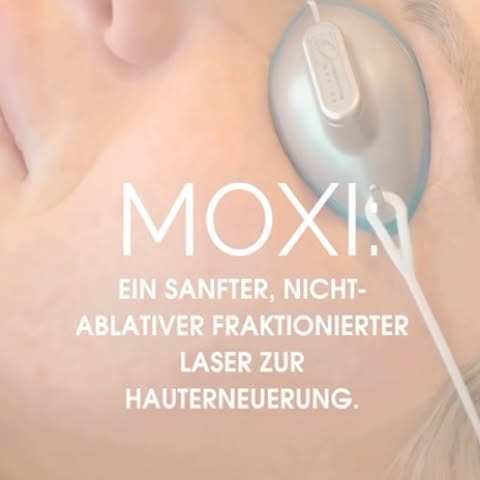 ✨ Möchten Sie Ihre Haut ohne lange Ausfallzeit sichtbar auffrischen?

MOXI® ist ein moderner Laser, 
