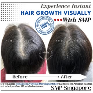𝐇𝐚𝐯𝐞 𝐲𝐨𝐮 𝐬𝐩𝐞𝐧𝐝 𝐡𝐮𝐧𝐝𝐫𝐞𝐝𝐬 𝐨𝐫 𝐞𝐯𝐞𝐧 𝐭𝐡𝐨𝐮𝐬𝐚𝐧𝐝𝐬 𝐨𝐧 𝐡𝐚𝐢𝐫 𝐠𝐫𝐨𝐰�