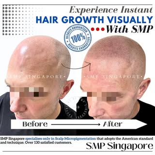 𝗧𝗵𝗲 𝗠𝗼𝘀𝘁 𝗡𝗮𝘁𝘂𝗿𝗮𝗹 𝗟𝗼𝗼𝗸𝗶𝗻𝗴 𝗦𝗠𝗣 - 𝗢𝗻𝗹𝘆 𝗮𝘁 𝗦𝗠𝗣 𝗦𝗶𝗻𝗴𝗮𝗽𝗼𝗿𝗲

No g