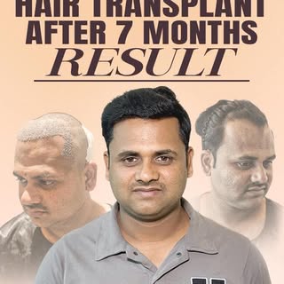 From thinning to thriving — the transformation is real.
At 7 months, you can clearly see stronger de