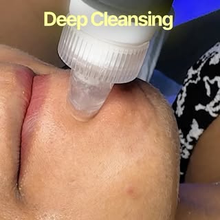 * Refresh. Rejuvenate. Glow. ✨

Book your HydraFacial today! 📞 9168003679

#hydrafacial #glowingski
