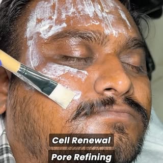 ✨ Yellow Peel: The Glow That Keeps Working! 💛

Not just a regular peel—Yellow Peel works deep withi