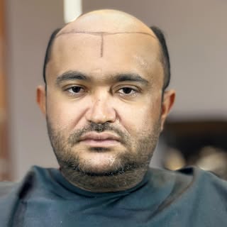 Não é só cabelo… é identidade restaurada. 🔥

Olha essa transformação.
De um “antes” carregado de in
