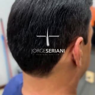 Resultado natural é prioridade.

Uma prótese capilar de qualidade não deve chamar atenção.

Ela deve