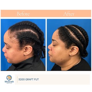 Ready to make a change? Reach out for a consultation and let’s get started 👏🏻 #hairtransformation 