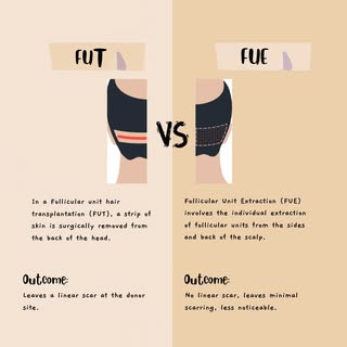 📌FUT and FUE techniques require skillful execution by an experienced surgeon and their team. It is 