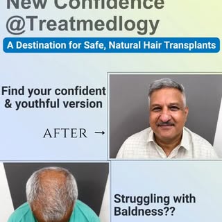 Are you considering a Hair Transplant procedure🤔

Meet Dr Samiksha Tyagi, a renowned Hair Transplan
