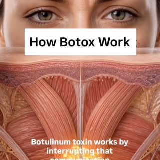 Ever wondered how Botox actually works? 💉✨

Botox works by temporarily relaxing specific facial mus