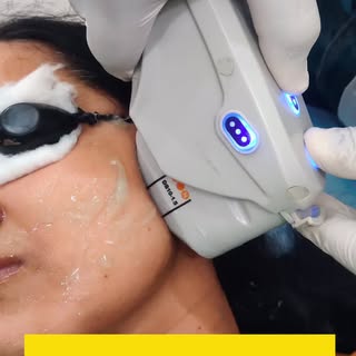 ✨ Lift, tighten, and rejuvenate your skin with the power of HIFU Treatment! 💆‍♀️

Experience a non-