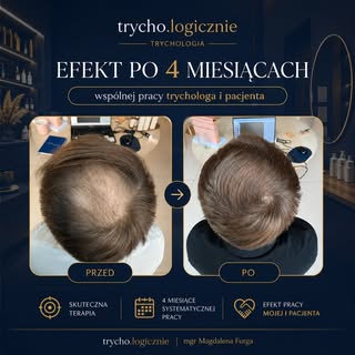 4 miesiące systematycznej pracy. Nie „cudowny preparat”. Nie przypadek.Tylko dobrze dobrana terapia,