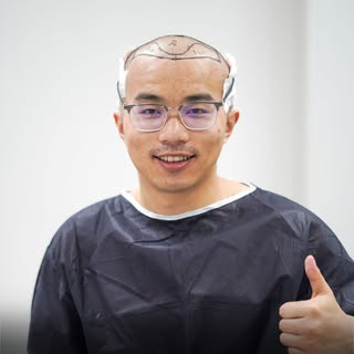 Say Goodbye to M-Pattern Baldness 

A natural hairline.
A fuller appearance.
A renewed confidence. �