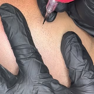 First session SMP #smp #scalpmicropigmentation #hairtattoo #microhairclinic #skalpmikropigmentacija 