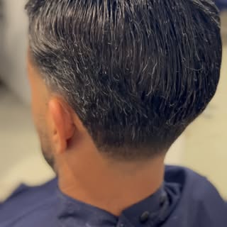 Agende sua avaliação e descubra como a prótese capilar pode transformar a sua imagem.

#ProteseCapil