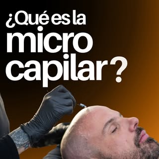 ¿CALVICIE? ¡AFUERA! ❌

¿Sabías que podes recuperar tu línea frontal y tu confianza en pocas sesiones