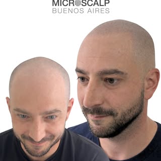 Un cambio sutil, natural y súper efectivo que transforma cómo te ves y cómo te mostrás al mundo. En 