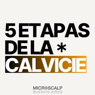 La mayoría de los hombres pasa por estas etapas… hasta que encuentran una solución.

¿En cuál estás 