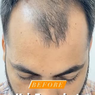 Book your Appointment today 

For More Information:

Email us at -
info@dermamiracle.in

Visit our w