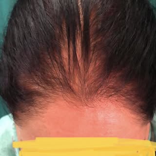 Hair care products
If you color, relax, straight, keratin your hair you could be damaging your hair 