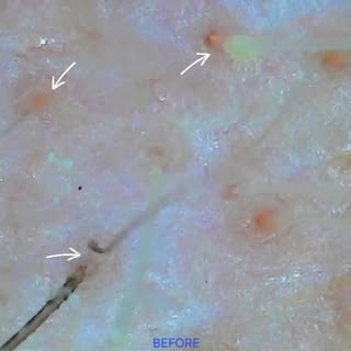 What Your Scalp Is Trying to Tell You...

Your scalp is living tissue—not just skin covered by hair.