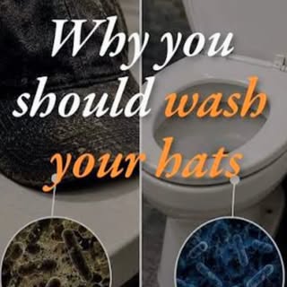 🧢 That Favorite Hat? It Might Be Trapping a Petri Dish on Your Scalp, Making it Dirtier Than a Publ