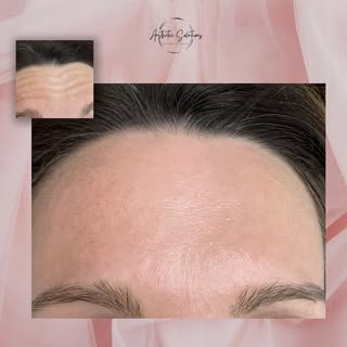 Tired of fine lines and wrinkles making you look older than you feel? We have multiple anti-wrinkle 