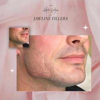 ✨ Define Your Profile with Jawline Fillers ✨

Jawline fillers are the perfect way to create a sharpe