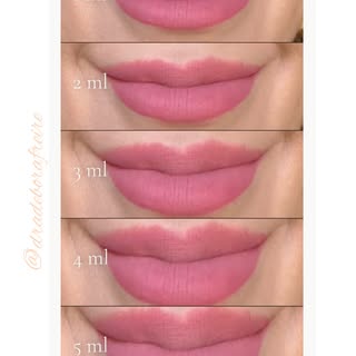 💋 Sonhando com lábios maiores? O segredo está na leveza!

Essa é apenas uma projeção , uma simulaçã