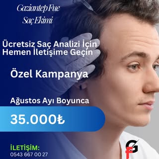 Saçlarınızdaki Değişime Ağustos’a Özel 35.000 ₺ İle Adım Atın, Ücretsiz Analiz Fırsatını Kaçırmayın!