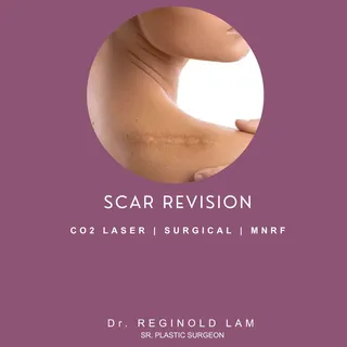 Rewrite Your Skin's History. Minimize Imperfections. Restore Flawless Texture. ✨🔬
 Accidental injur