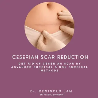 Honor Your Journey. Restore Your Skin. Flawless Structural Healing. ✨🛡️

A C-section brings life's 