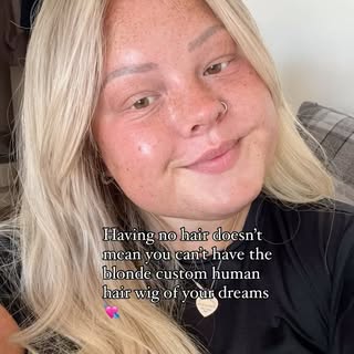 Want to order your own blonde custom human hair wig like this beautiful Alopecia wig wearer ? 👀👀👀