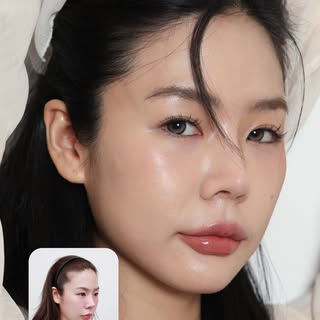 เทียบให้ชัด ๆ ปลูกผมเทคนิค Long Hair 
จากปัญหาเว้าบาง แหว่งหูแมว ไม่มั่นใจเวลารวบผม
หลังปลูกไม่ต้องพ