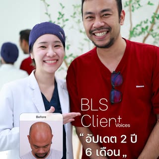 ปลูกผมเปลี่ยนชีวิต แก้ปัญหาศีรษะล้าน! 
Happy มากจริง ๆ ลืมรูปเก่าไปเลย!
ผ่านไป 2 ปี 6 เดือน ผมที่ปลู