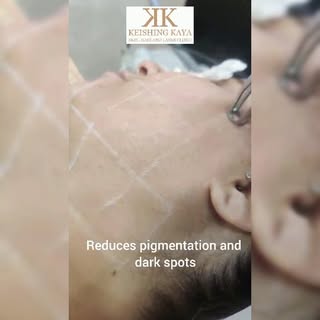 Laser toning (carbon laser facial for glow & pigmentation), laser hair treatments, skin rejuvenation