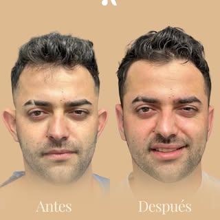A veces, un pequeño cambio puede hacer una gran diferencia en cómo te sientes contigo mismo.

La oto