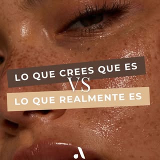 ✨ ¿Seguro que sabes qué tiene tu piel?

No todas las manchas, venitas o marcas se tratan igual. En A