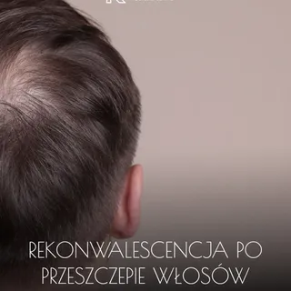 ⏳ Jak długo trwa rekonwalescencja po przeszczepie włosów?

To jedno z najczęściej zadawanych pytań p