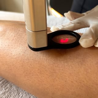 Scars don’t have to be permanent 🤍

At All Skin Clinic, we treat scars at the source — not just the