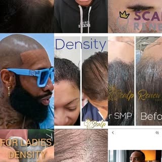Change your Life with Scalp Micropigmentation!

No more Baldness, no more Topic,
ONLY CONFIDENCE!

F